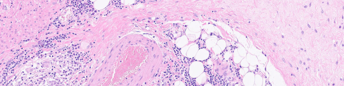 Sk&auml;rmklipp Appendix n&auml;rbild